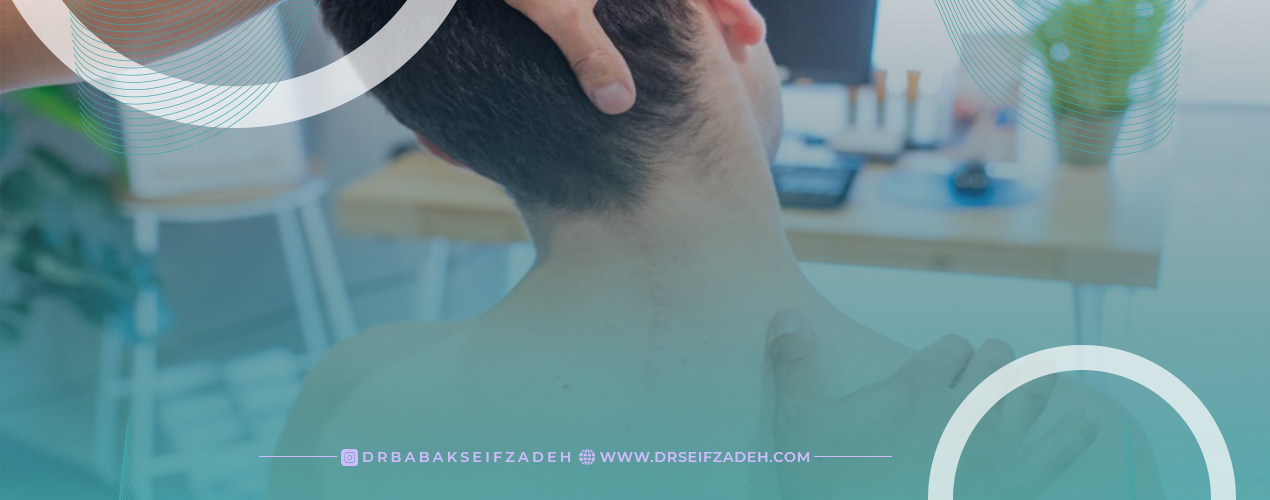 درمان دیسک گردن