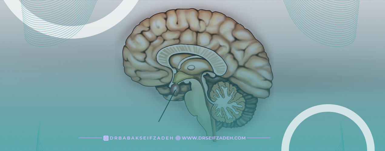 درمان تومور هیپوفیز