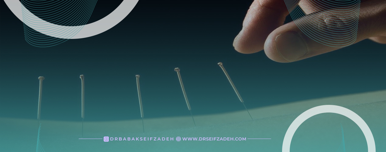 آسیب های قابل درمان با روش درای نیدلینگ