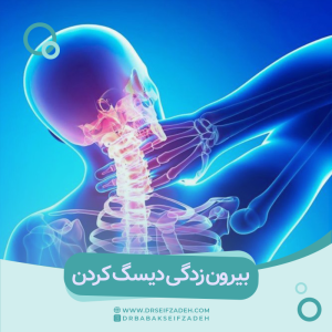 بیرون زدگی دیسک گردن