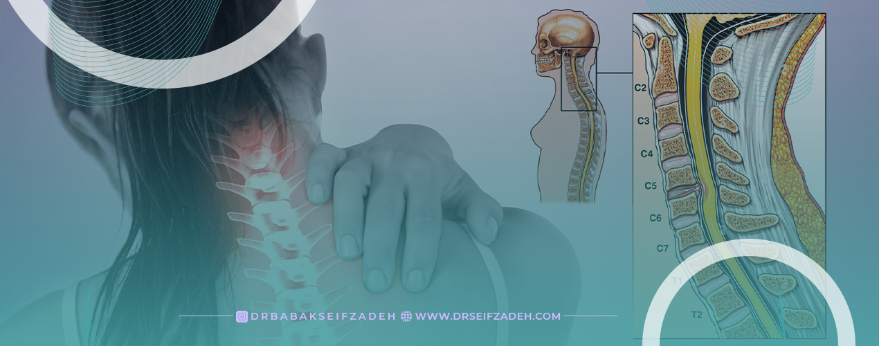 علائم بیرون زدگی دیسک گردن