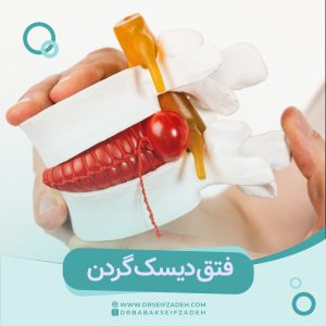 فتق دیسک گردن چیست و چگونه درمان میشود؟