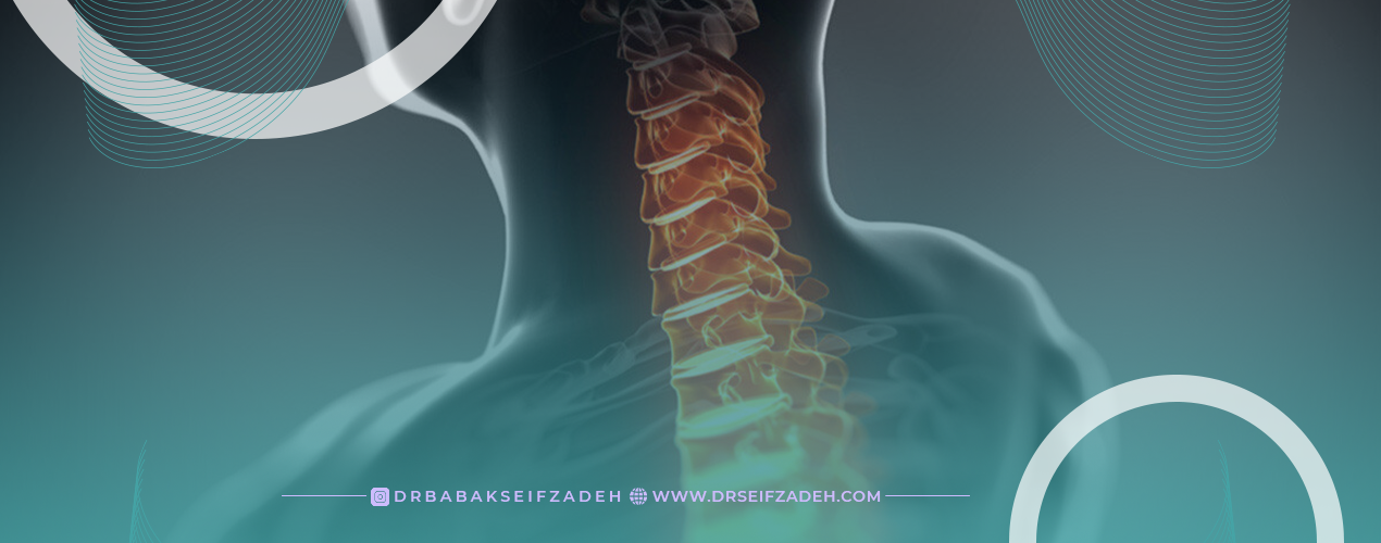 روش های موثر برای درمان بیرون زدگی دیسک گردن